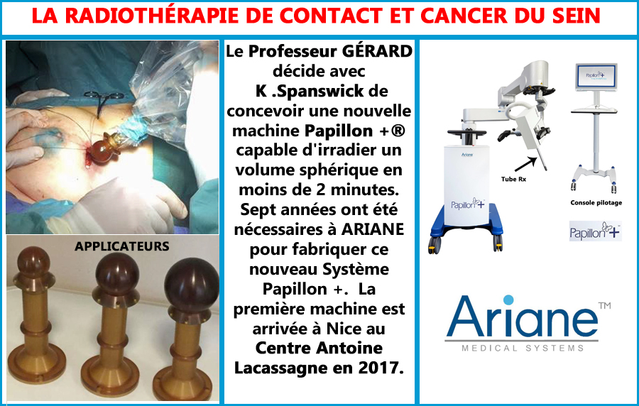 Radiothérapie de contact, pour le cancer du sein avec PAPILLON +